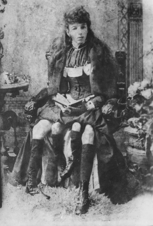 Myrtle Corbin, the four-legged woman.
