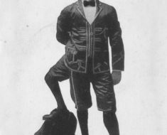 Francesco Lentini - Three-Legged Wonder of Sideshow History