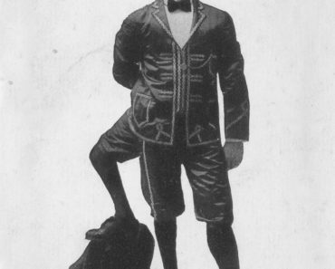 Francesco Lentini - Three-Legged Wonder of Sideshow History