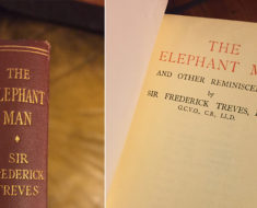 The Elephant Man and Other Reminiscences, by Sir Frederick Treves