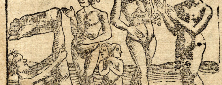 An engraving showing (from left to right) a monopod or sciapod, a female cyclops, conjoined twins, a blemmye, and a cynocephaly. From Sebastian Münster's Cosmographia (1544). Via Wikimedia Commons.