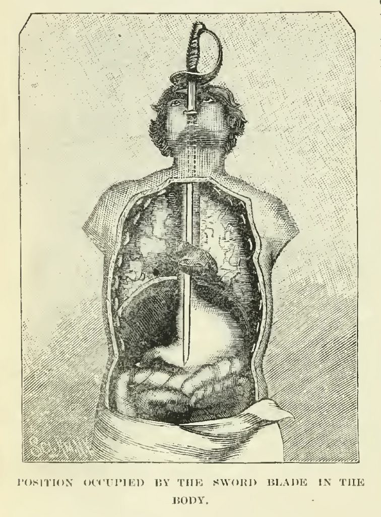 Where the sword goes, according to the late nineteenth-century book, Magic: Stage Illusions and Scientific Diversions, Including Trick Photography